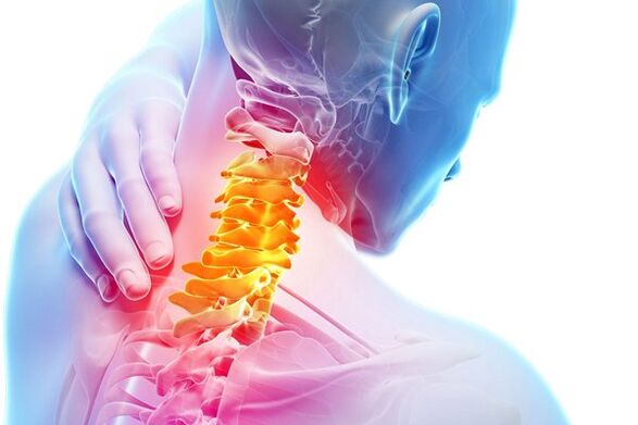 Uzroci cervikalne osteohondroze