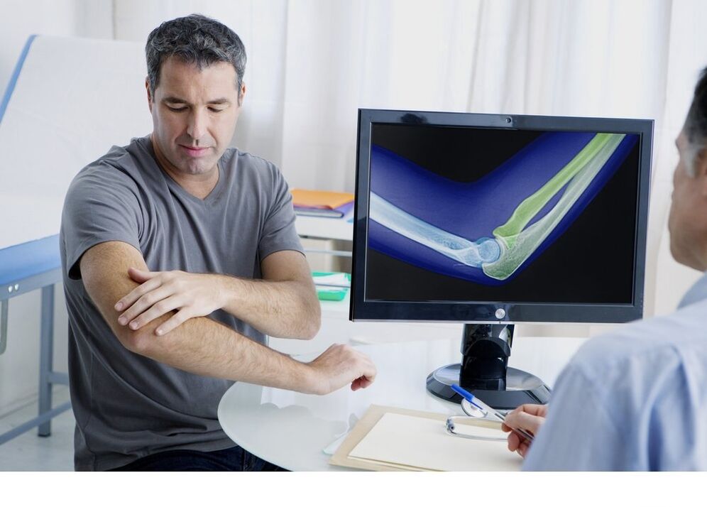 artroza lakatnog zgloba u x -ray slici
