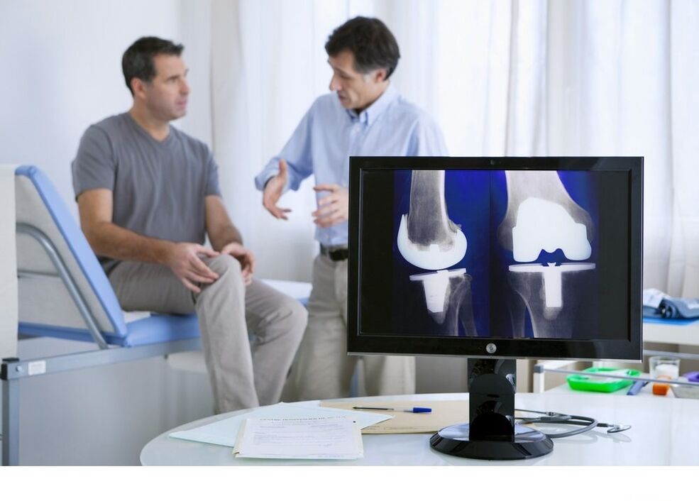 artroza zgloba koljena u x -ray slici